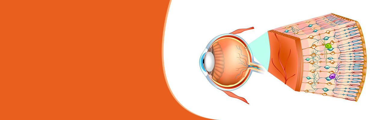 What are various retinal diseases?
