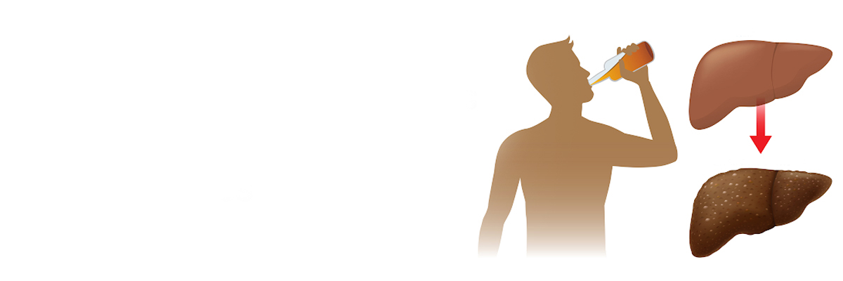 Prevalence and Risk Factors for Alcohol Related Liver Diseases