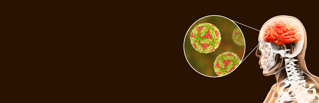 Should every case of encephalitis be treated?