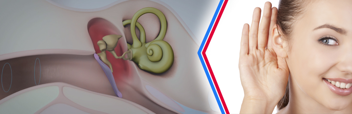 What are the causes of sensorineural hearing loss?
