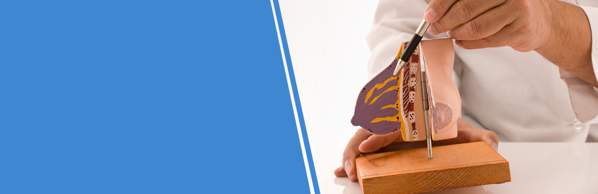 What are some other Risk factors in Breast Cancer?