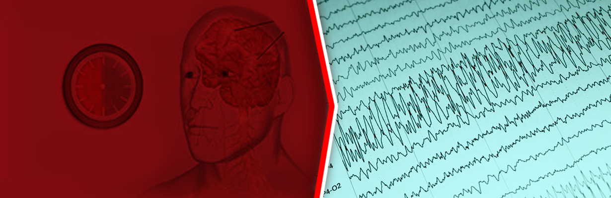 What is the management of status epilepticus?