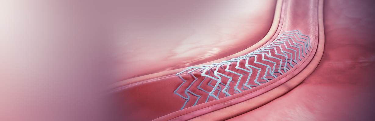 What is the role of absorbable stents in acute MI?