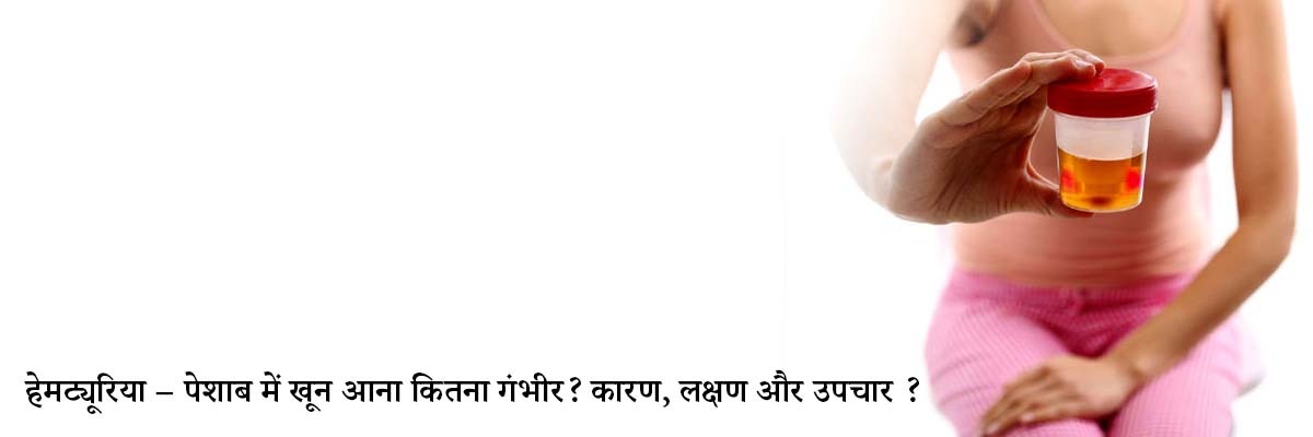 हेमट्यूरिया – पेशाब में खून आना कितना गंभीर? कारण, लक्षण और उपचार |  Hematuria (Blood in Urine) in Hindi