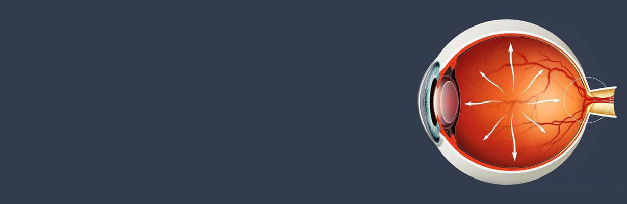 How should we set target IOP?