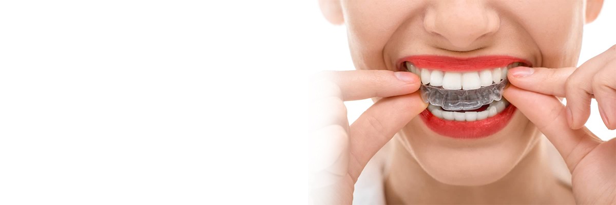 How to Straighten Teeth | Medtalks