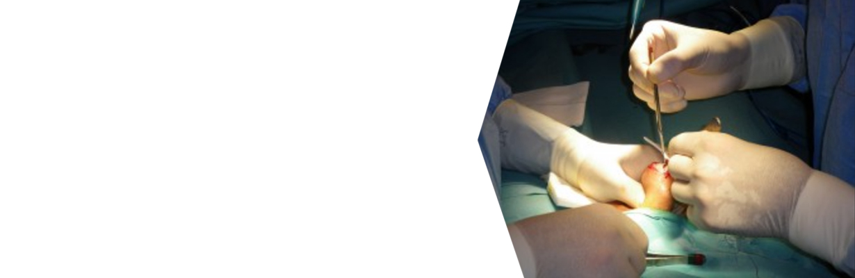 What is the role of testicular biopsy and male infertility?