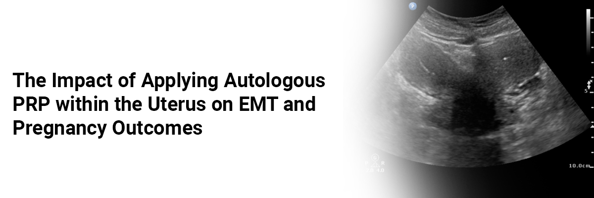 The Impact of Applying Autologous PRP within the Uterus on EMT and Pregnancy Outcomes