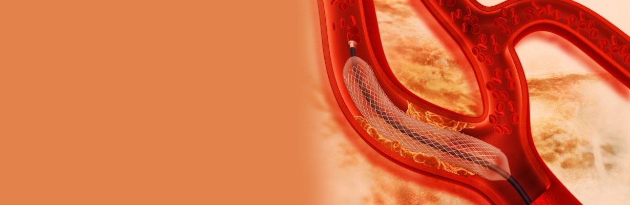 What are the third generation stents?