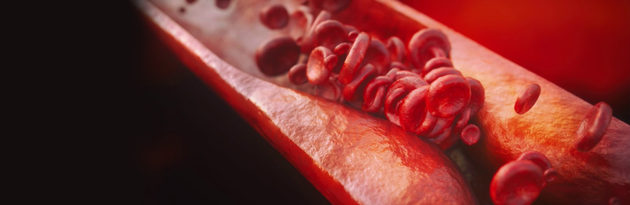 What is the role of ticlopidine in acute MI?