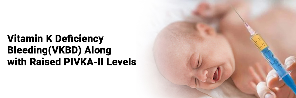 Vitamin K Deficiency Bleeding(VKBD) along with raised PIVKA-II Levels