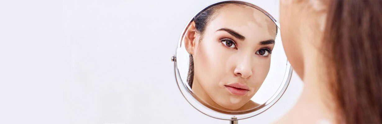 What is the treatment of vitiligo?