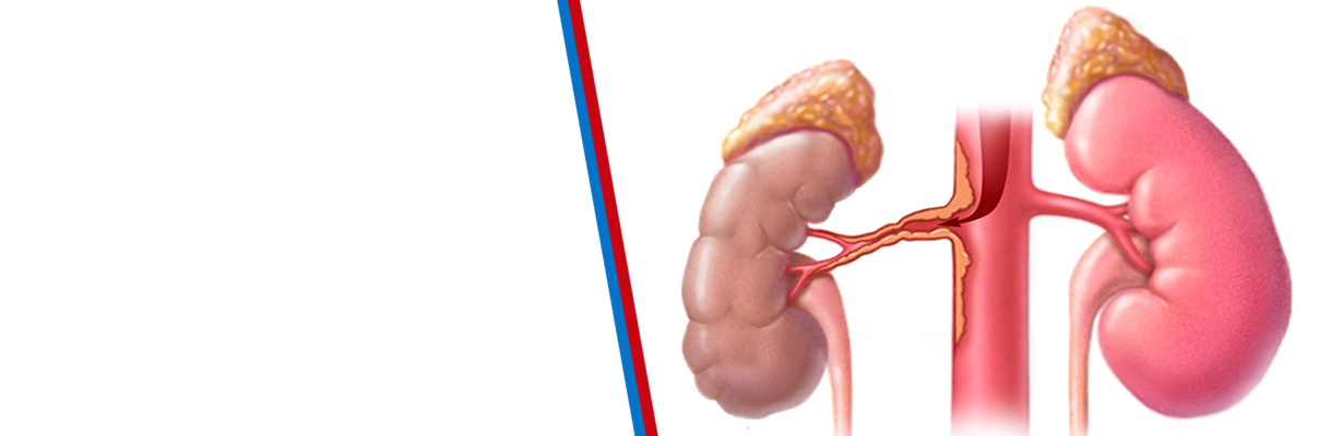 Why do we check for renal artery atherosclerosis?
