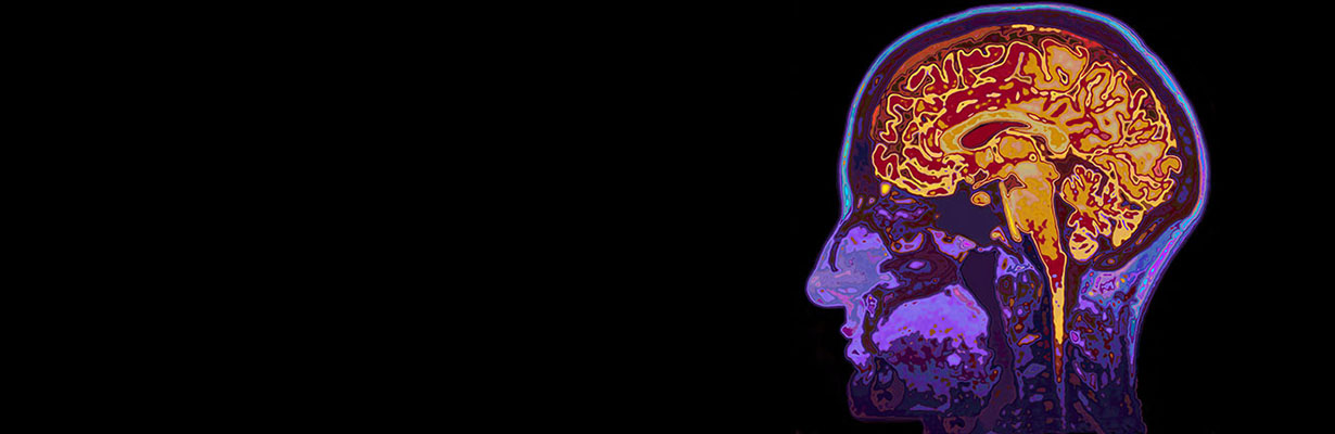 What are the new treatment modalities in dementia?