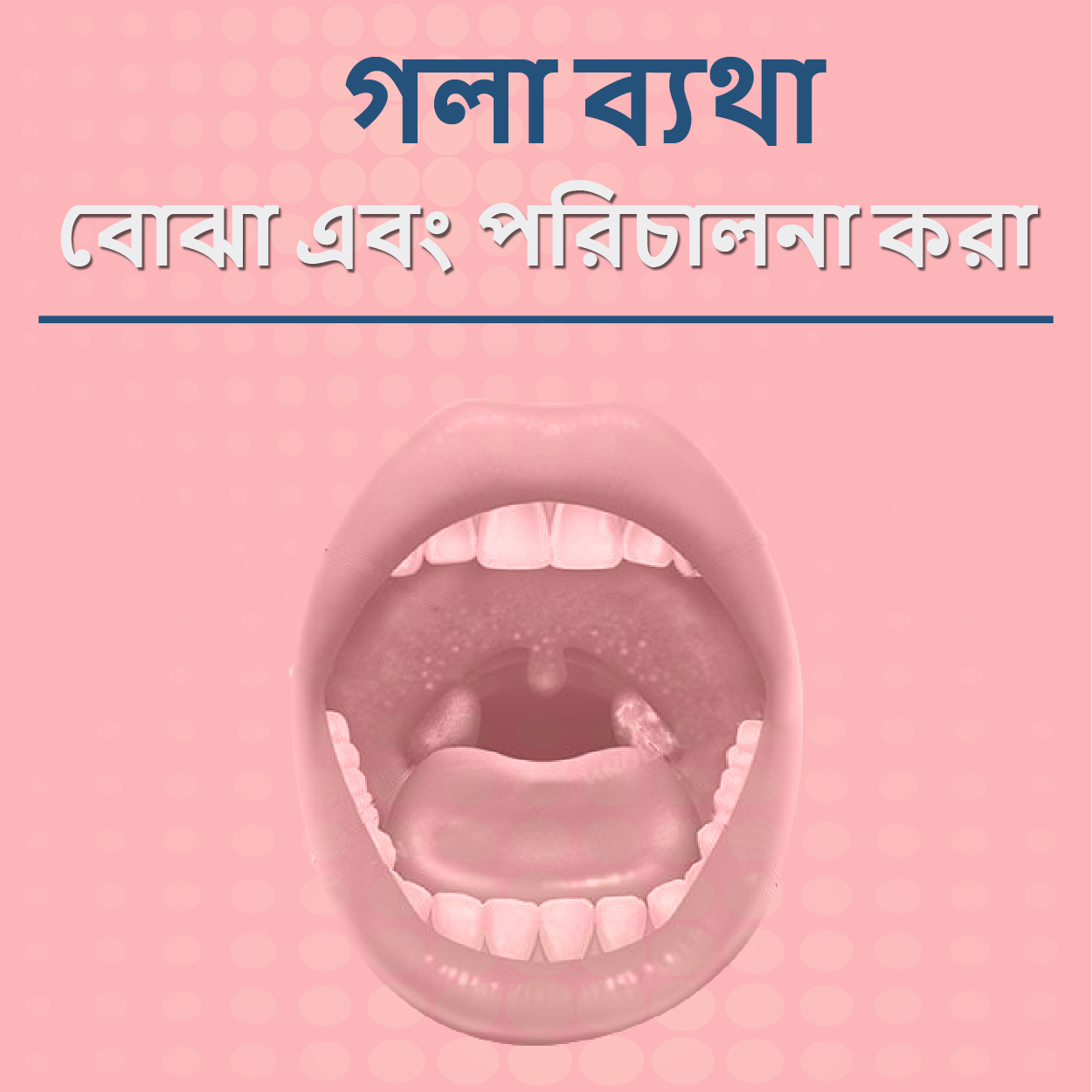 গলাব্যথাবোঝাএবংপরিচালনাকরা...