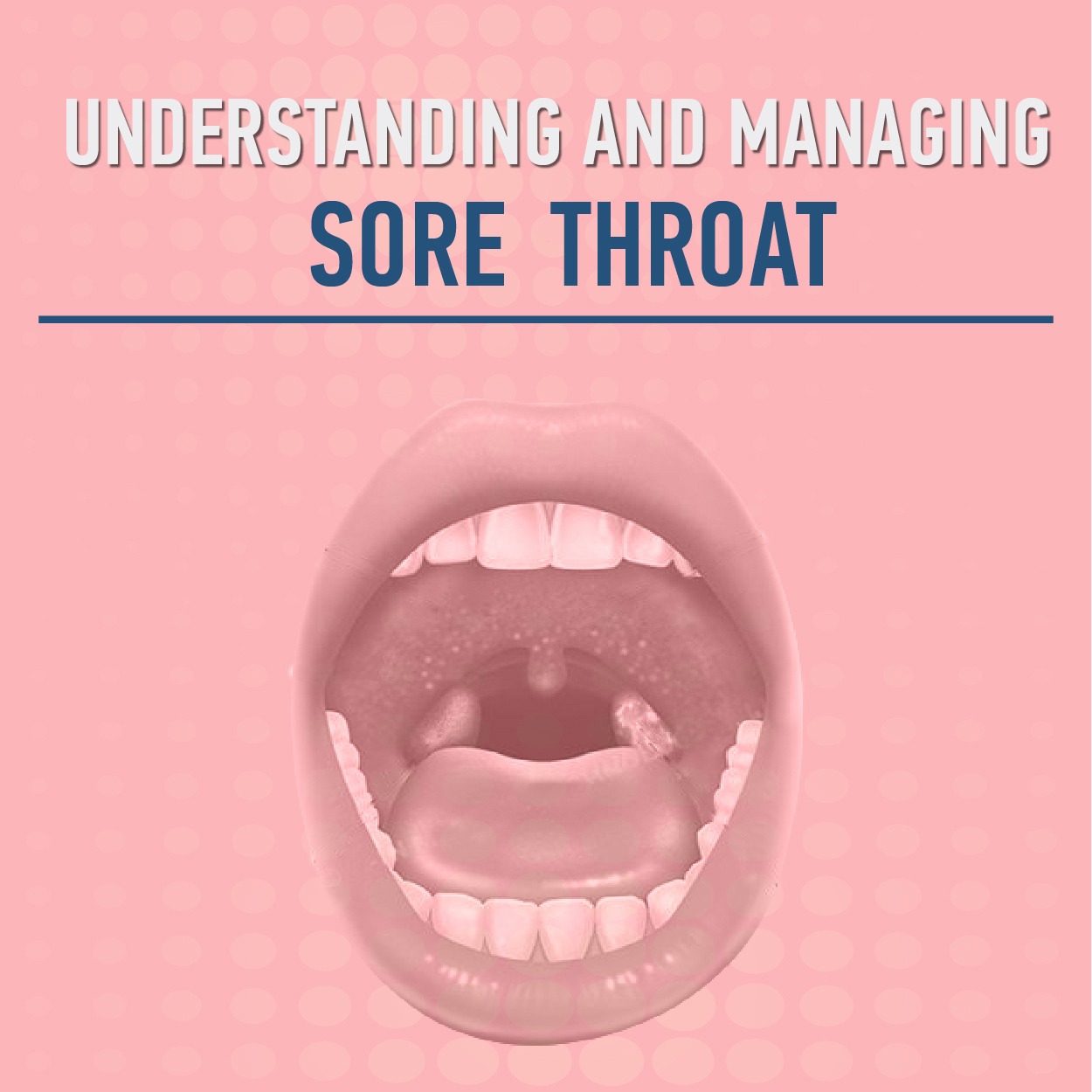 Understanding and Managing Sore Throat