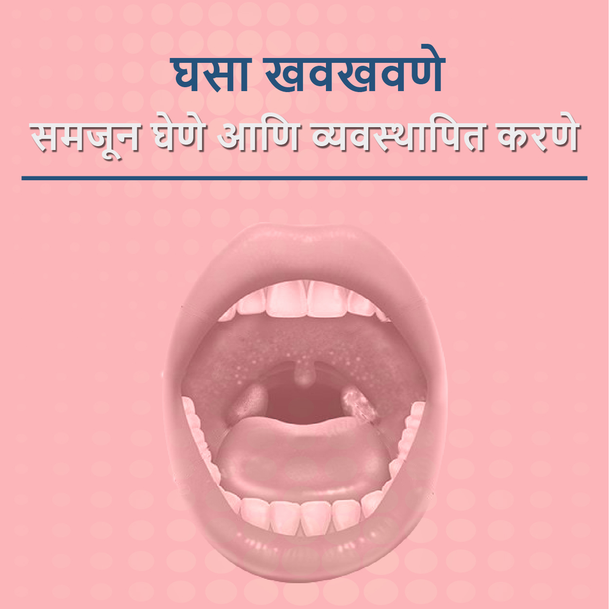 घसा खवखवणे समजून घेणे आणि व्यवस्थापित करणे...