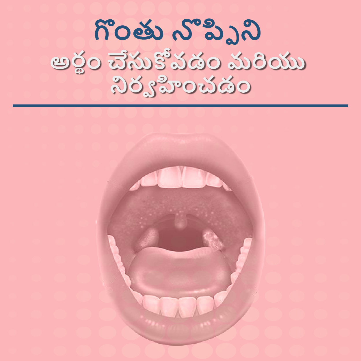 గొంతు నొప్పిని అర్థం చేసుకోవడం మరియు నిర్వహించడం...