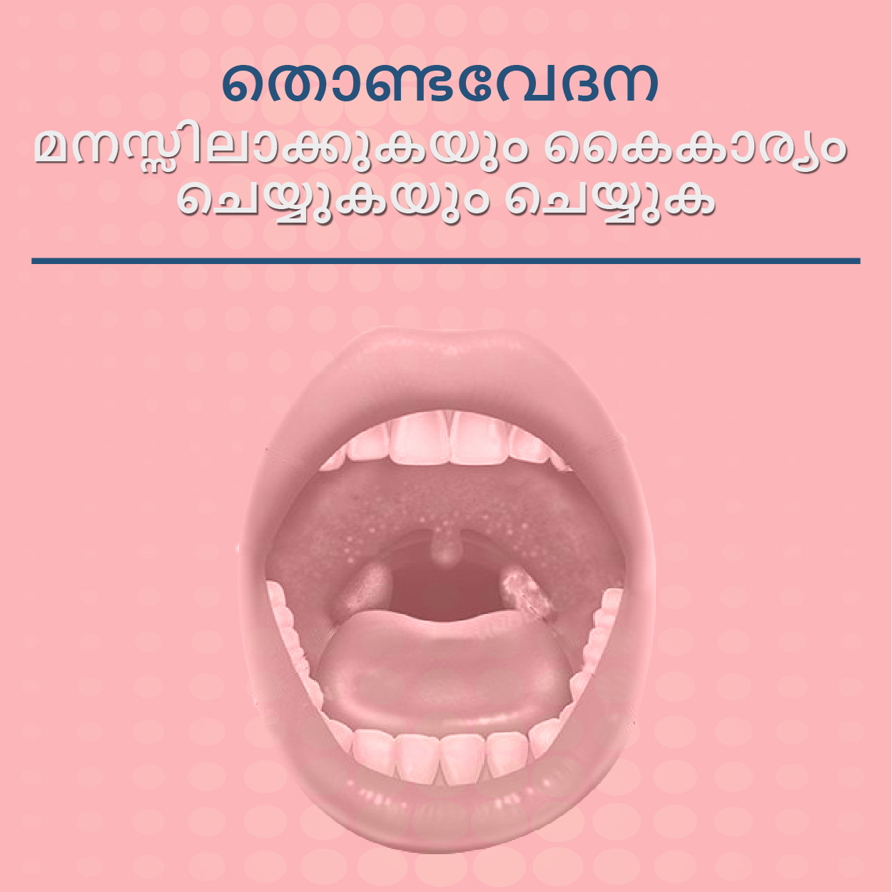 തൊണ്ടവേദന മനസ്സിലാക്കുകയും കൈകാര്യം ചെയ്യുകയും ചെയ്യുക...