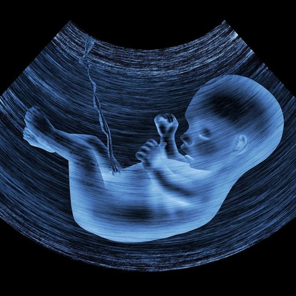 Clinical Guidelines for Inducing Fetal A...