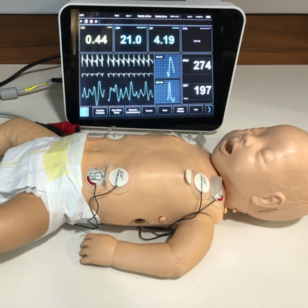 Non-Invasive Cardiac Output Monitoring in Neonatology Using Electrical ...