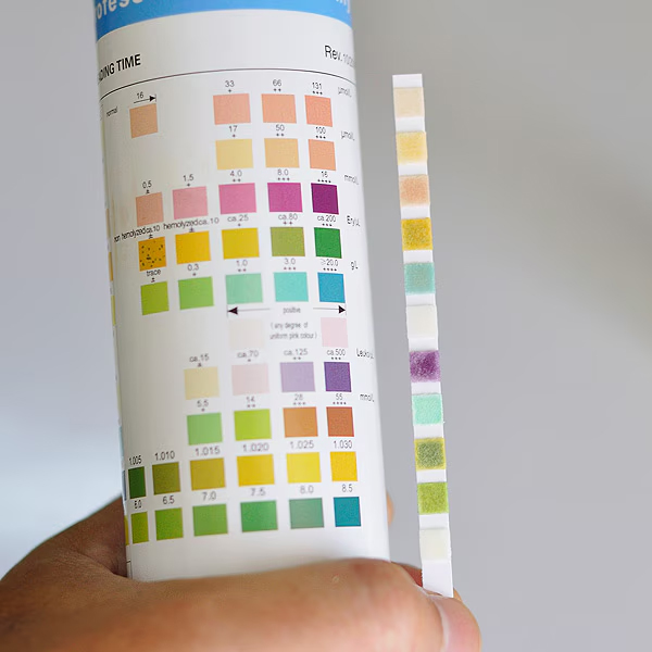 Analysis of Urine Dipstick Analysis for...
