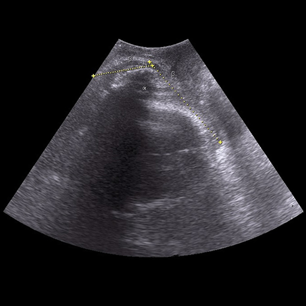 Intrapartum Sonography: Redefining Evaluation of Fetal Head Position
