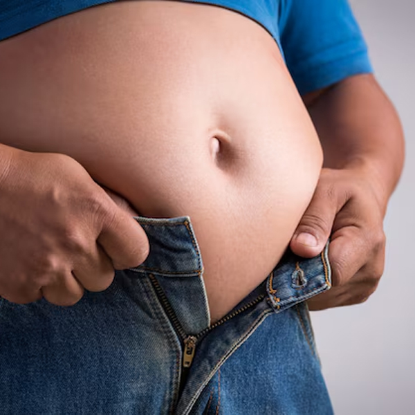 Decoding Obesity: Causes Beyond Calories