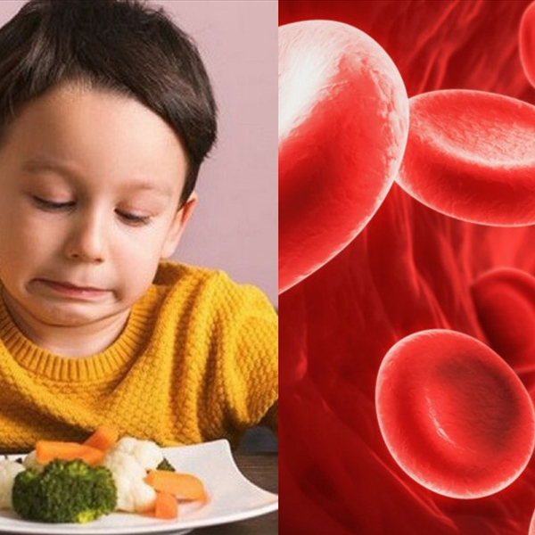 Chronic Iron Deficiency and Cognitive Function in Early Childhood