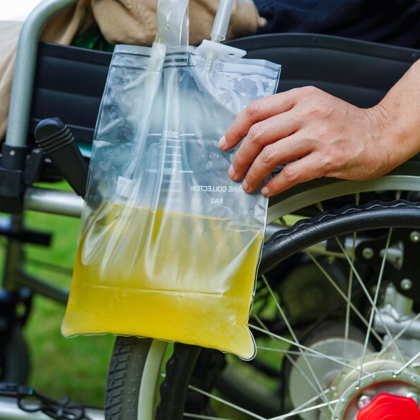 कंडोम कैथेटर क्या है? Condom Catheter in Hindi