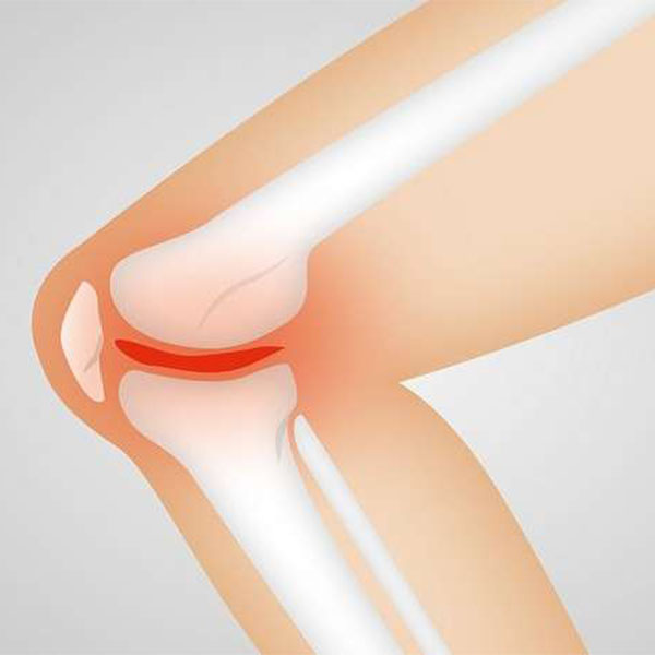 How common is Osteoarthritis Knee in India? | Dr. Ramneek Mahajan