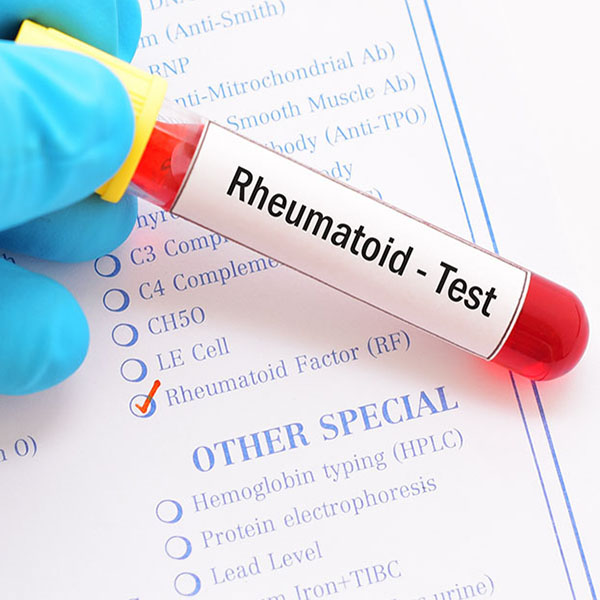Is Rheumatoid factor a diagnostic test for rheumatoid arthritis?