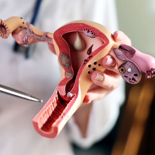 Levonorgestrel Intrauterine System in the Management of Abnormal ...