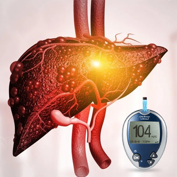Diabetes and Chronic Liver Disease
