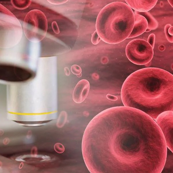 Aplastic Anemia Symptoms and Causes Medtalks