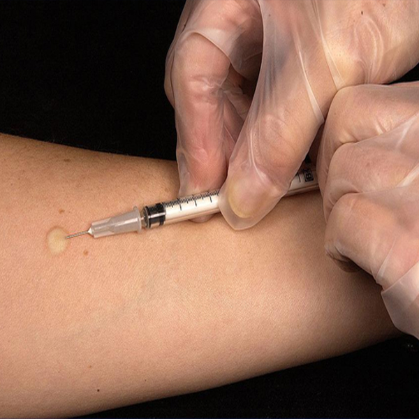 Intradermal Eye Injection How to Give an Intradermal Injection | MedTalks