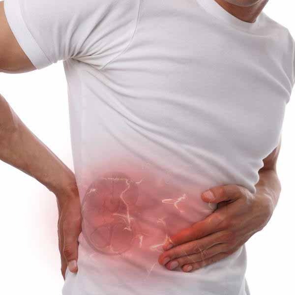 Kidney Stone Signs, Symptoms, Treatment & Prevention Medtalks