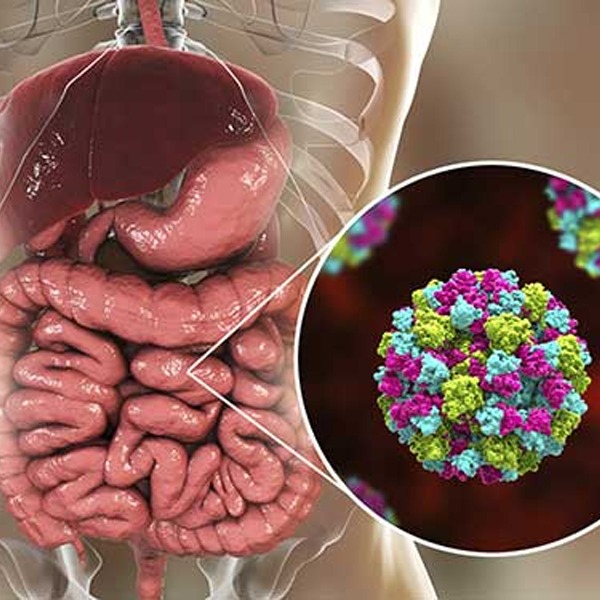 Norovirus Infection - Symptoms and Causes - Medtalks