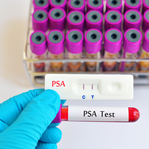 When should we do screening PSA?