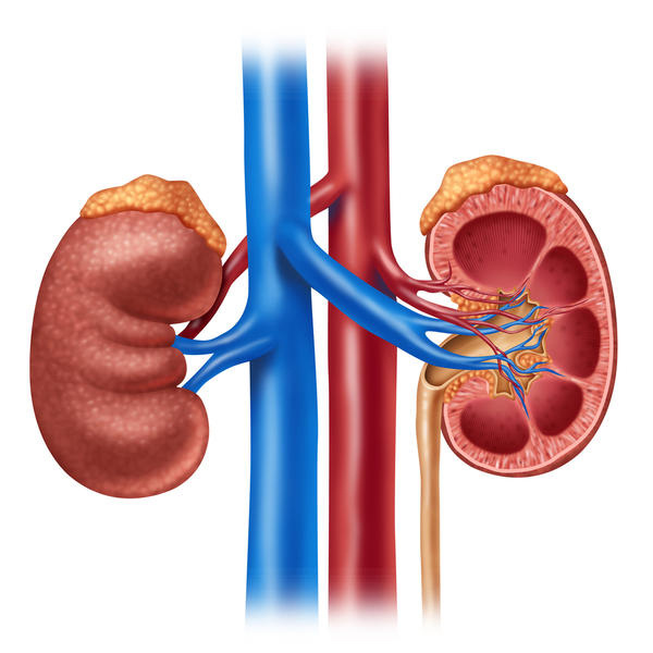 Can bypass be done along with renal artery stenosis?