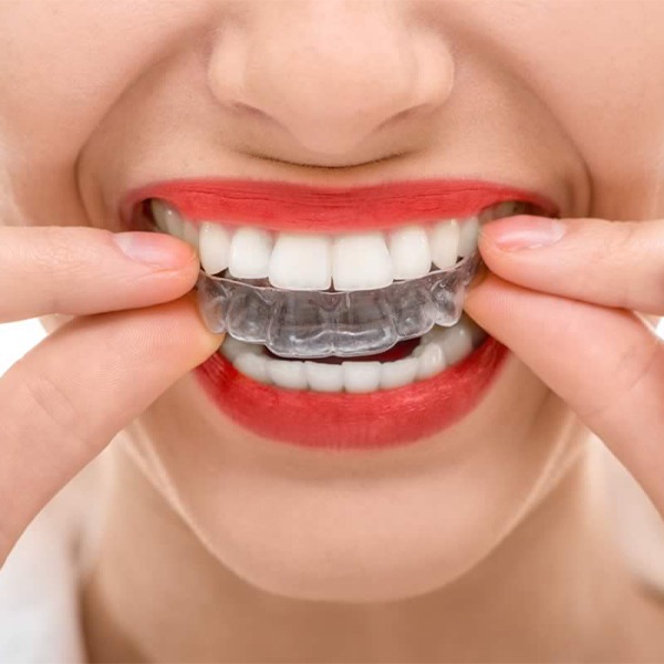 How to Straighten Teeth Dental Health and Teeth Straightening Medtalks